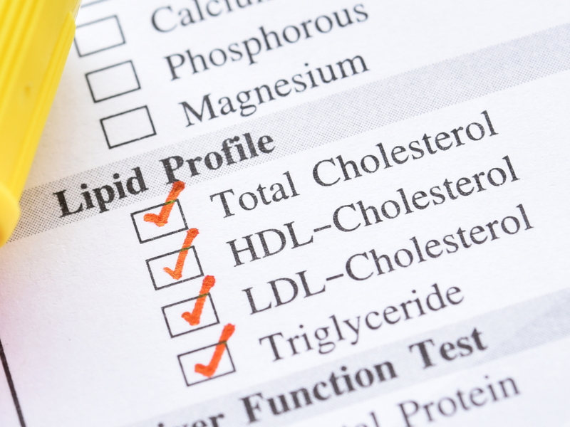 Cholesterol Testing Understanding Your Numbers and Cardiovascular Risk